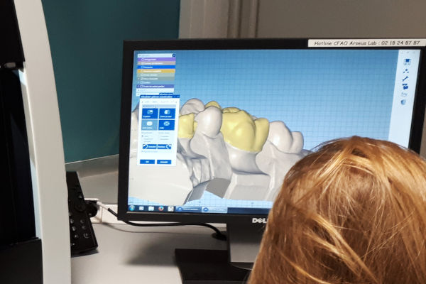 apprenti qui modélise des prothèses dentaires sur ordinateur
